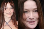 Carla Bruni, top model degli anni '90 e cantante di successo, ha mantenuto intatta la sua bellezza nonostante l'avanzare dell'età, grazie a trattamenti estetici mirati.