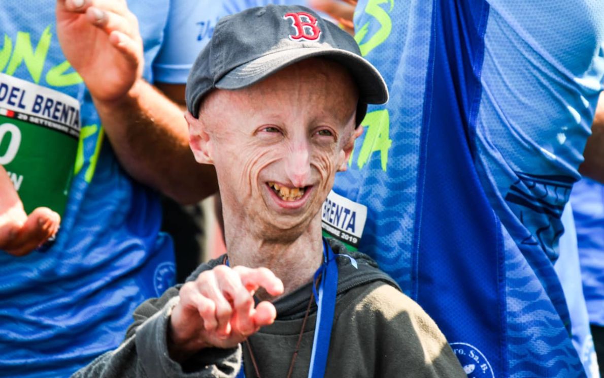 È morto Sammy Basso, noto per essere stato la persona più longeva al mondo affetta da progeria. Aveva 28 anni.